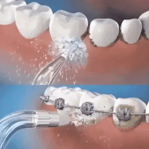 Chorro Dental JetClean Pro